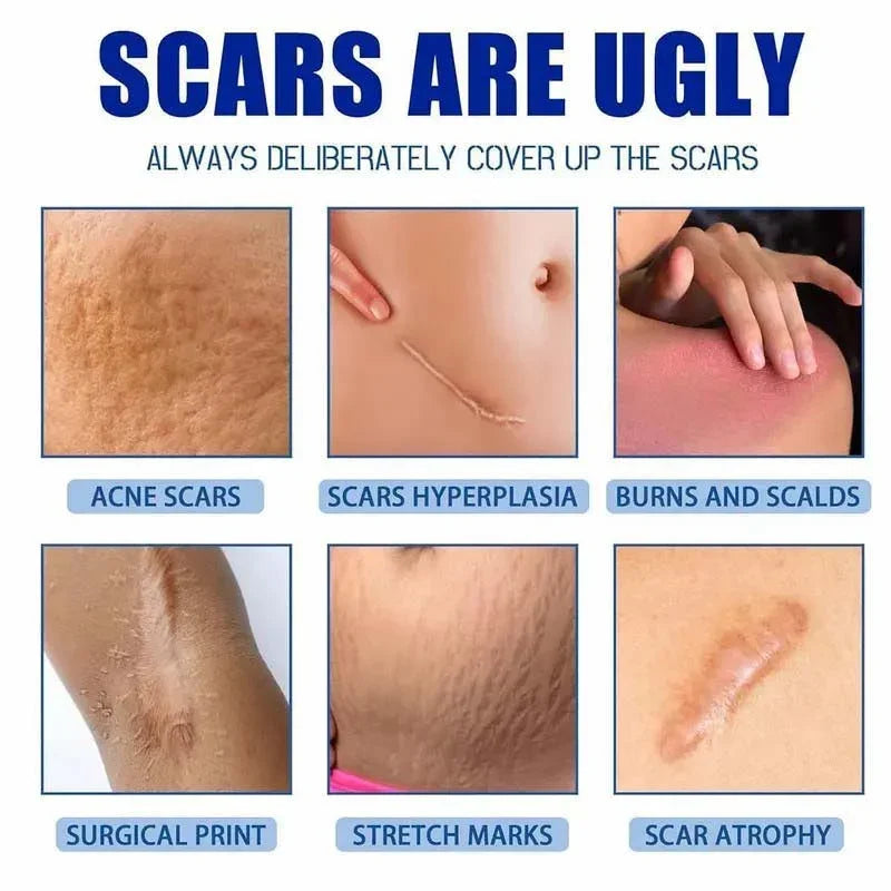 Fempick Scar Smooth – Great Care Cream for All Types of Skin Marks 🧴
