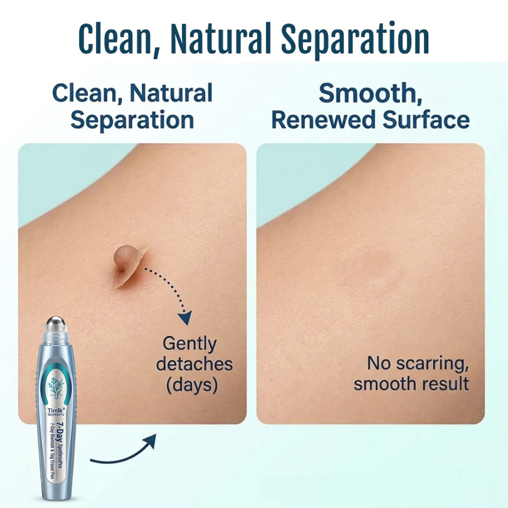 Timlk® SpotlessPro Advanced Skin Care Pen