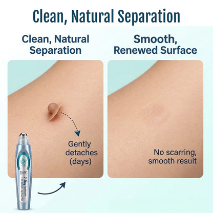 Timlk® SpotlessPro Advanced Skin Care Pen