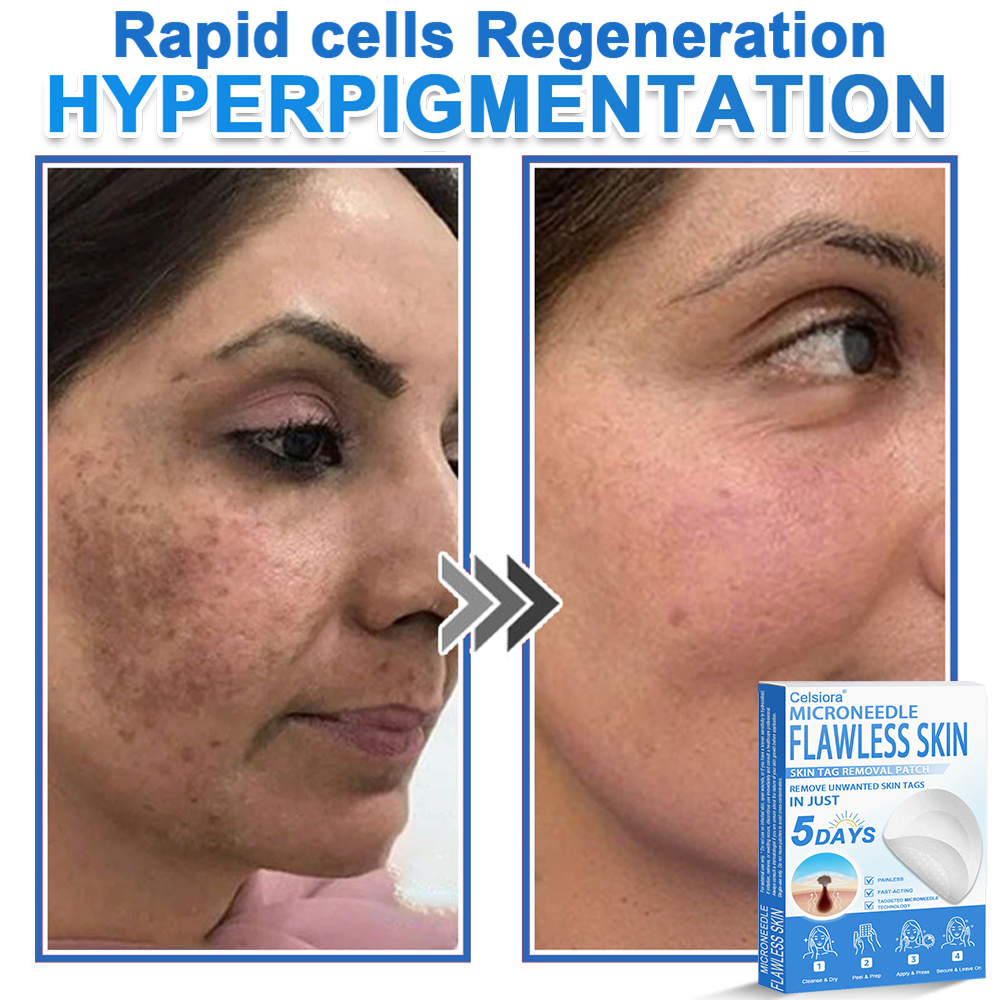 🎁2-in-1 Microneedle & Hydrocolloid Patch | Raised Moles,Acne, Flat Warts & Skin Tags Remover | Improves Wrinkles, Scars & Blemishes | Invisible Pimple Patches for Face & Body