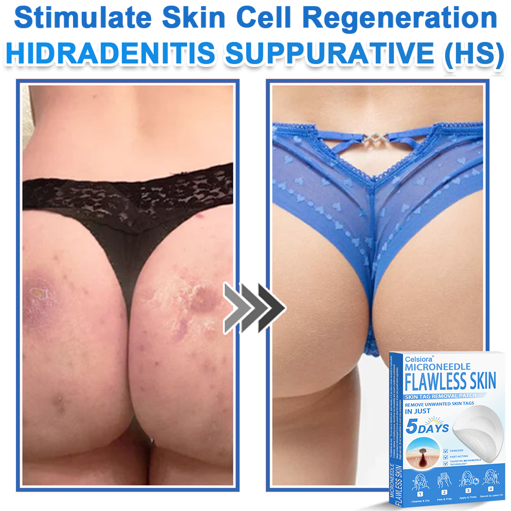 🎁2-in-1 Microneedle & Hydrocolloid Patch | Raised Moles,Acne, Flat Warts & Skin Tags Remover | Improves Wrinkles, Scars & Blemishes | Invisible Pimple Patches for Face & Body