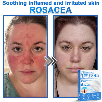 🎁2-in-1 Microneedle & Hydrocolloid Patch | Raised Moles,Acne, Flat Warts & Skin Tags Remover | Improves Wrinkles, Scars & Blemishes | Invisible Pimple Patches for Face & Body