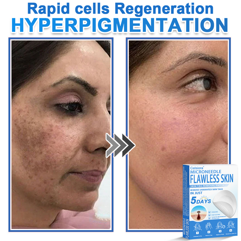 🎁2-in-1 Microneedle & Hydrocolloid Patch | Raised Moles,Acne, Flat Warts & Skin Tags Remover | Improves Wrinkles, Scars & Blemishes | Invisible Pimple Patches for Face & Body