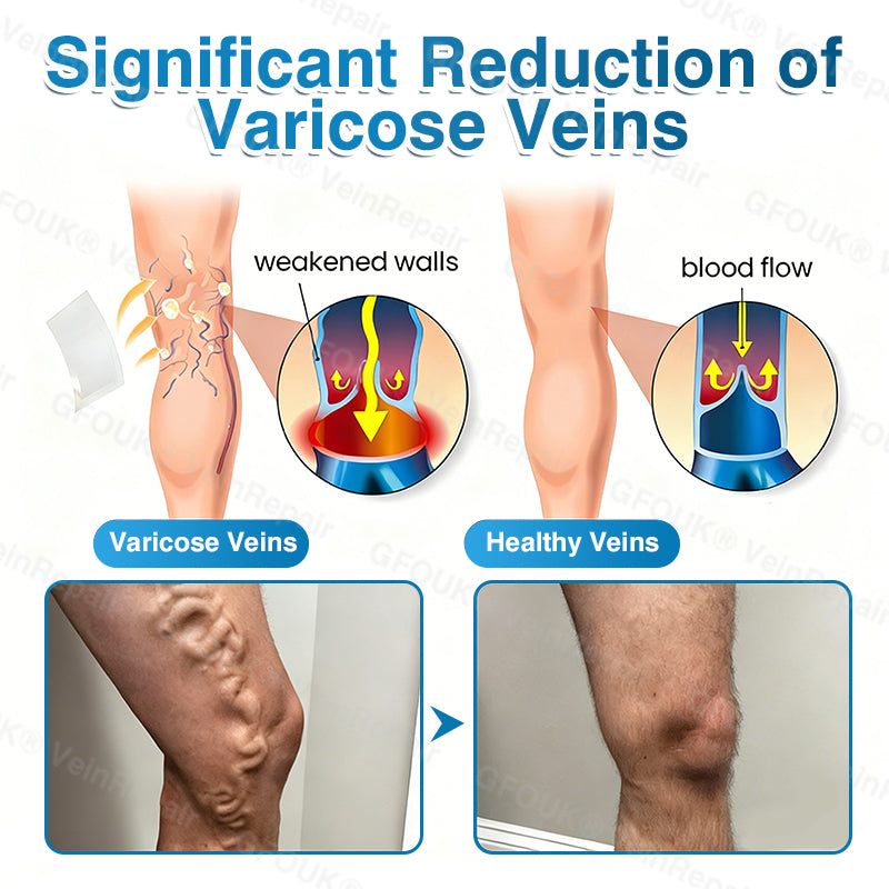 VeinRepair Microneedle Patch Roll⚡Instant Relief, Long-Term Results