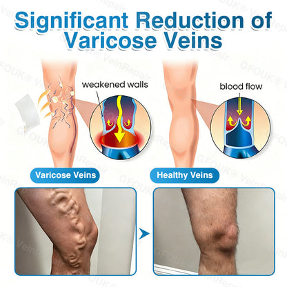 VeinRepair Microneedle Patch Roll⚡Instant Relief, Long-Term Results