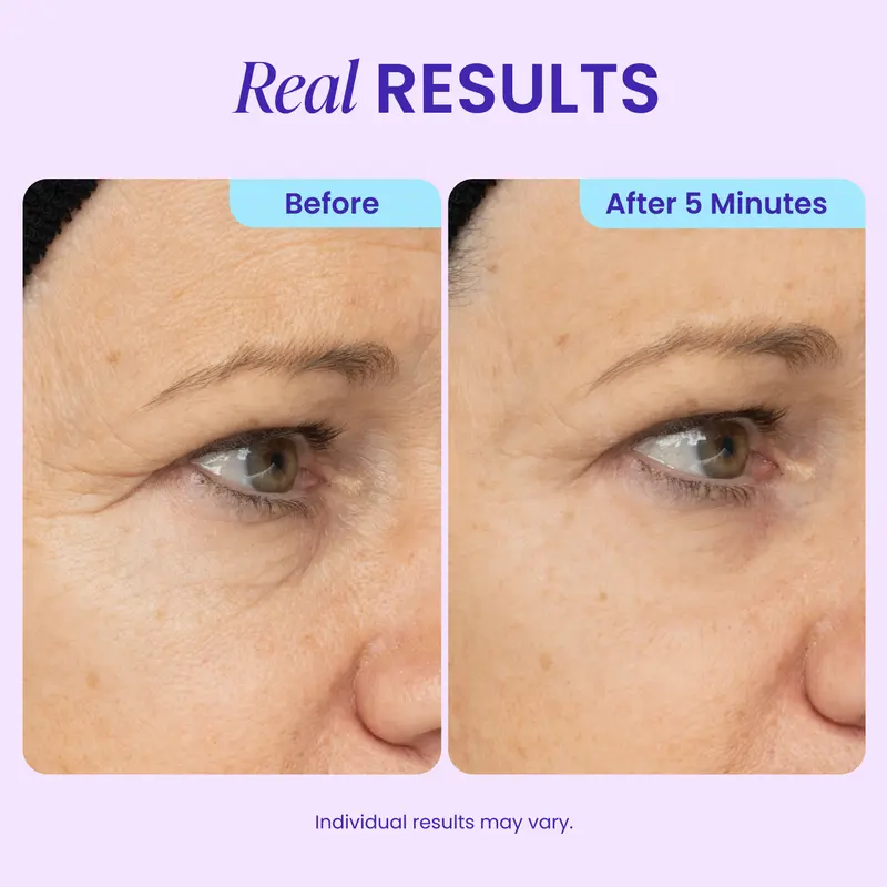 Plainlygoods Instant Lift Eye Gel – Bye Bye Eye Bags & Dark Circles