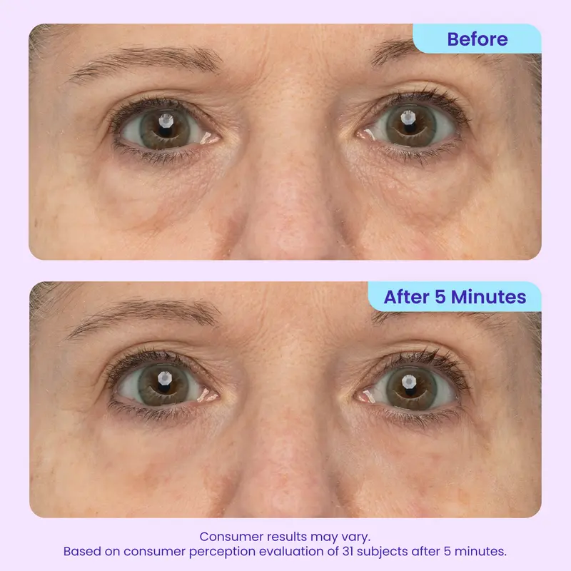 Plainlygoods Instant Lift Eye Gel – Bye Bye Eye Bags & Dark Circles