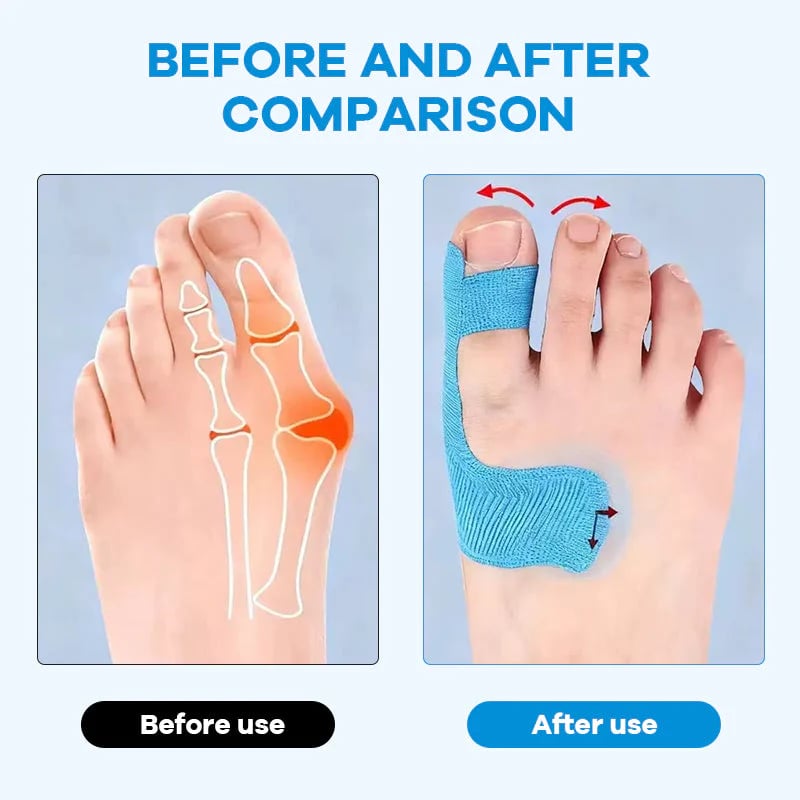Bunion Relief Toe Correction Wrap