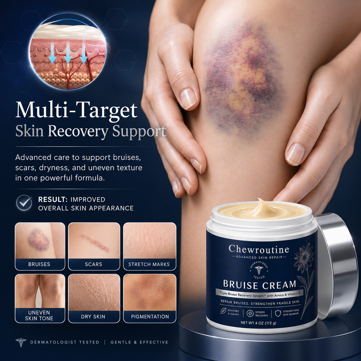 💥100K+ SOLD💕- ChewRoutine® Bruise Repair & Skin-Strengthening Cream