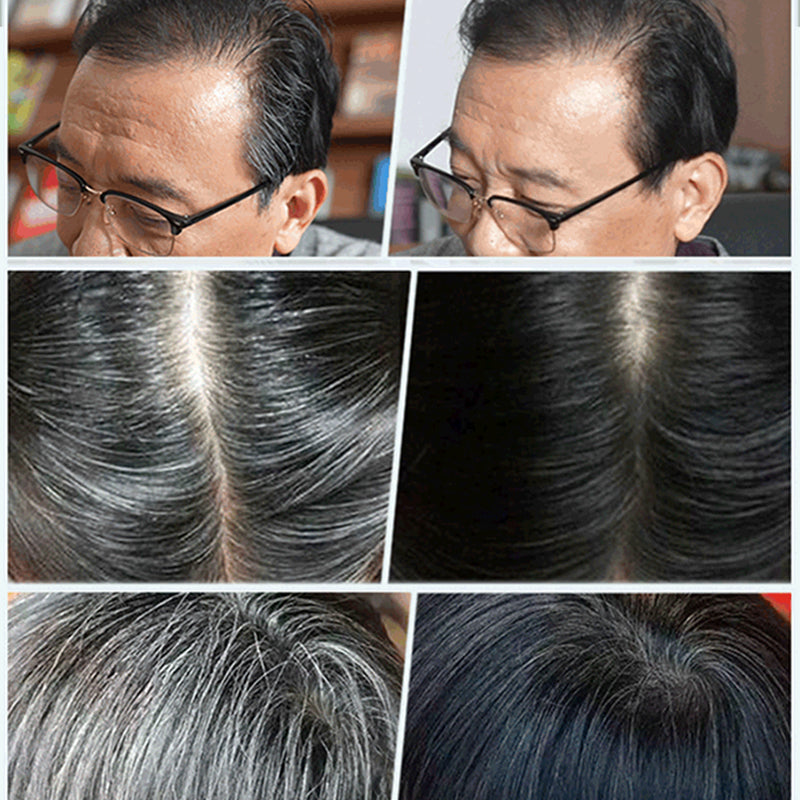 🔥Plant Extract Hair Dye Essence, Mild Irritation-Free Gray Hair Coverage Hair Color Cream With Ginseng Polygonum Extract At Home Hair Care For Men Women