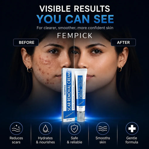 Fempick Scar Smooth – Great Care Cream for All Types of Skin Marks 🧴