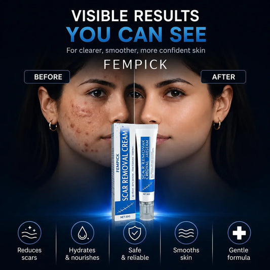 Fempick Scar Smooth – Great Care Cream for All Types of Skin Marks 🧴