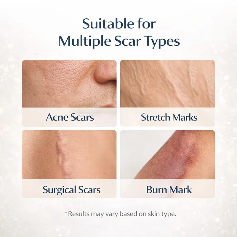 Fempick Scar Smooth – Great Care Cream for All Types of Skin Marks 🧴