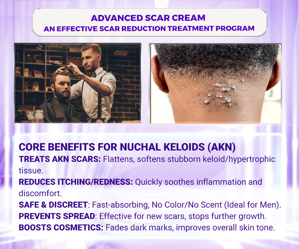 Abera Kelo Scar Care Cream - Top Seller