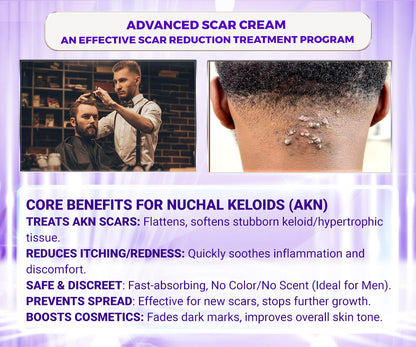Abera Kelo Scar Care Cream - Top Seller