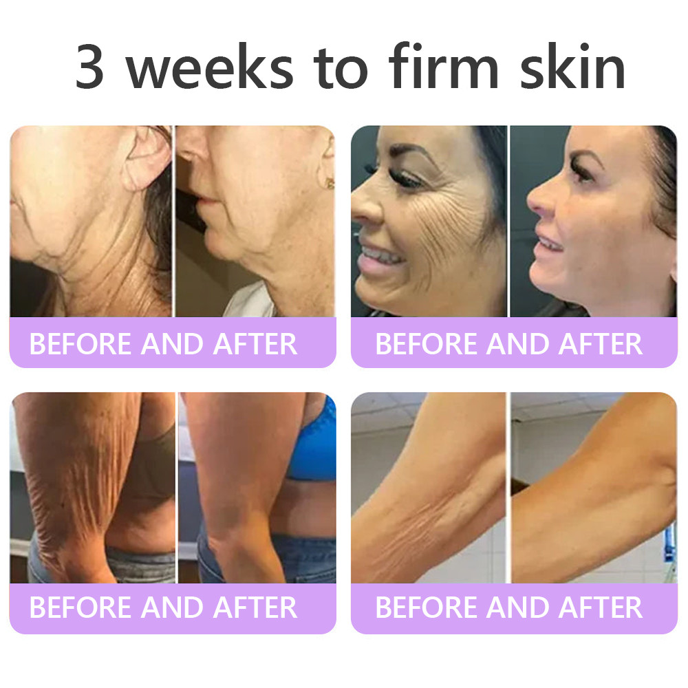 Aeramisgoods®🔥PDRN Multi-Peptide Massaging Body Roller Cream- Anti-aging, Hydrating, Skin Firming & Lifting, Skin Repair, Even Tone, Acne and Dark Spot Treatment, Wart and Mole Removal, and Psoriasis Relief