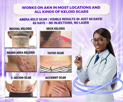 Abera Kelo Scar Care Cream - Top Seller