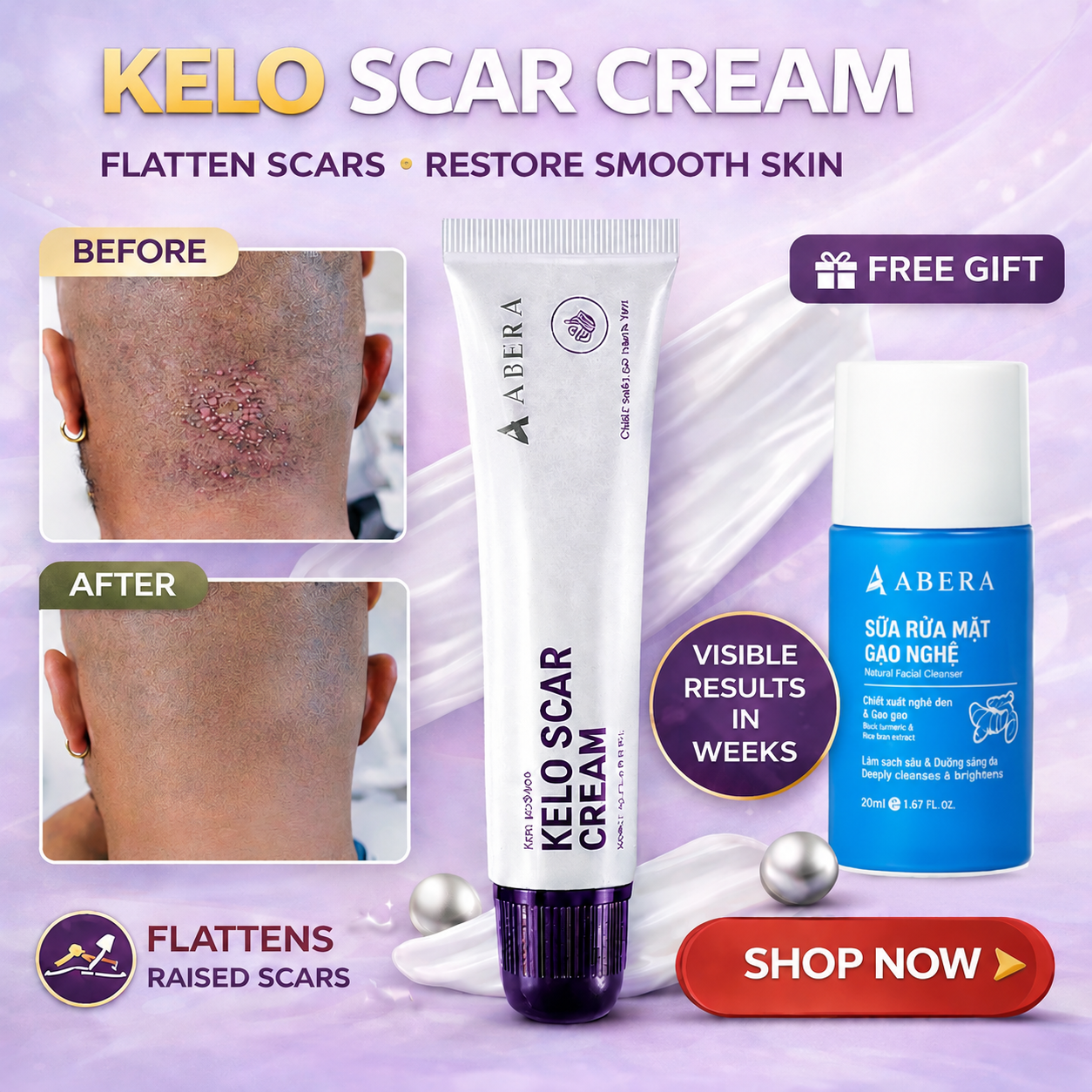 Abera Kelo Scar Care Cream - Top Seller