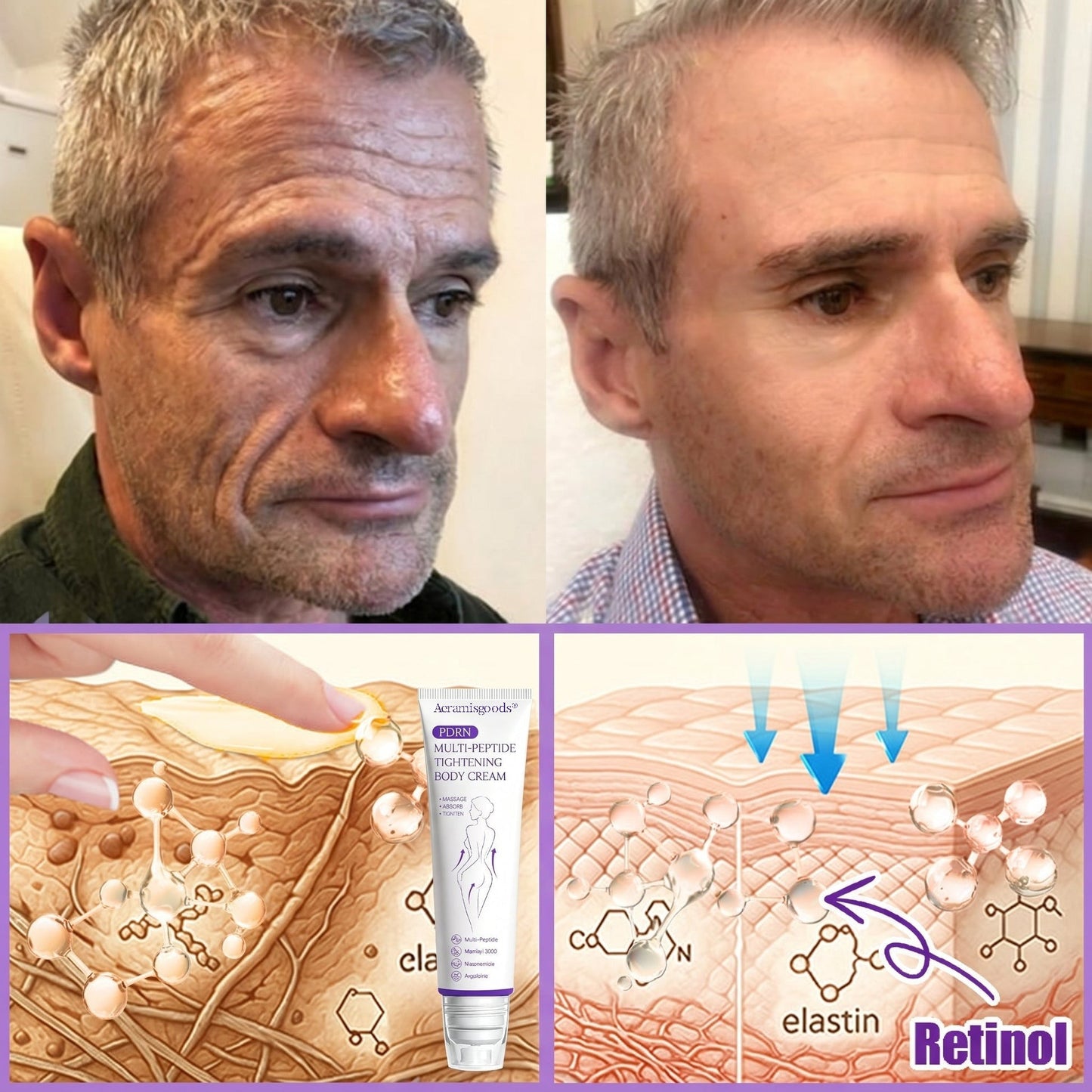 Aeramisgoods®🔥PDRN Multi-Peptide Massaging Body Roller Cream- Anti-aging, Hydrating, Skin Firming & Lifting, Skin Repair, Even Tone, Acne and Dark Spot Treatment, Wart and Mole Removal, and Psoriasis Relief