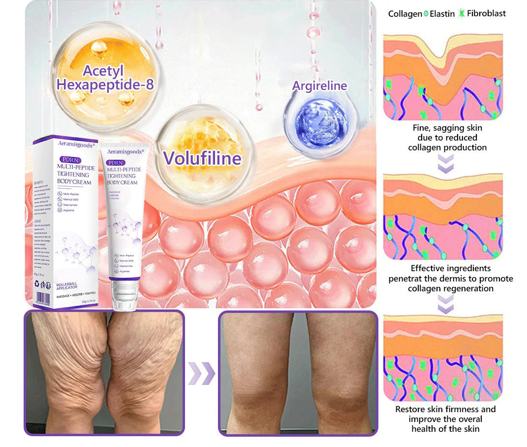 Aeramisgoods®🔥PDRN Multi-Peptide Massaging Body Roller Cream- Anti-aging, Hydrating, Skin Firming & Lifting, Skin Repair, Even Tone, Acne and Dark Spot Treatment, Wart and Mole Removal, and Psoriasis Relief
