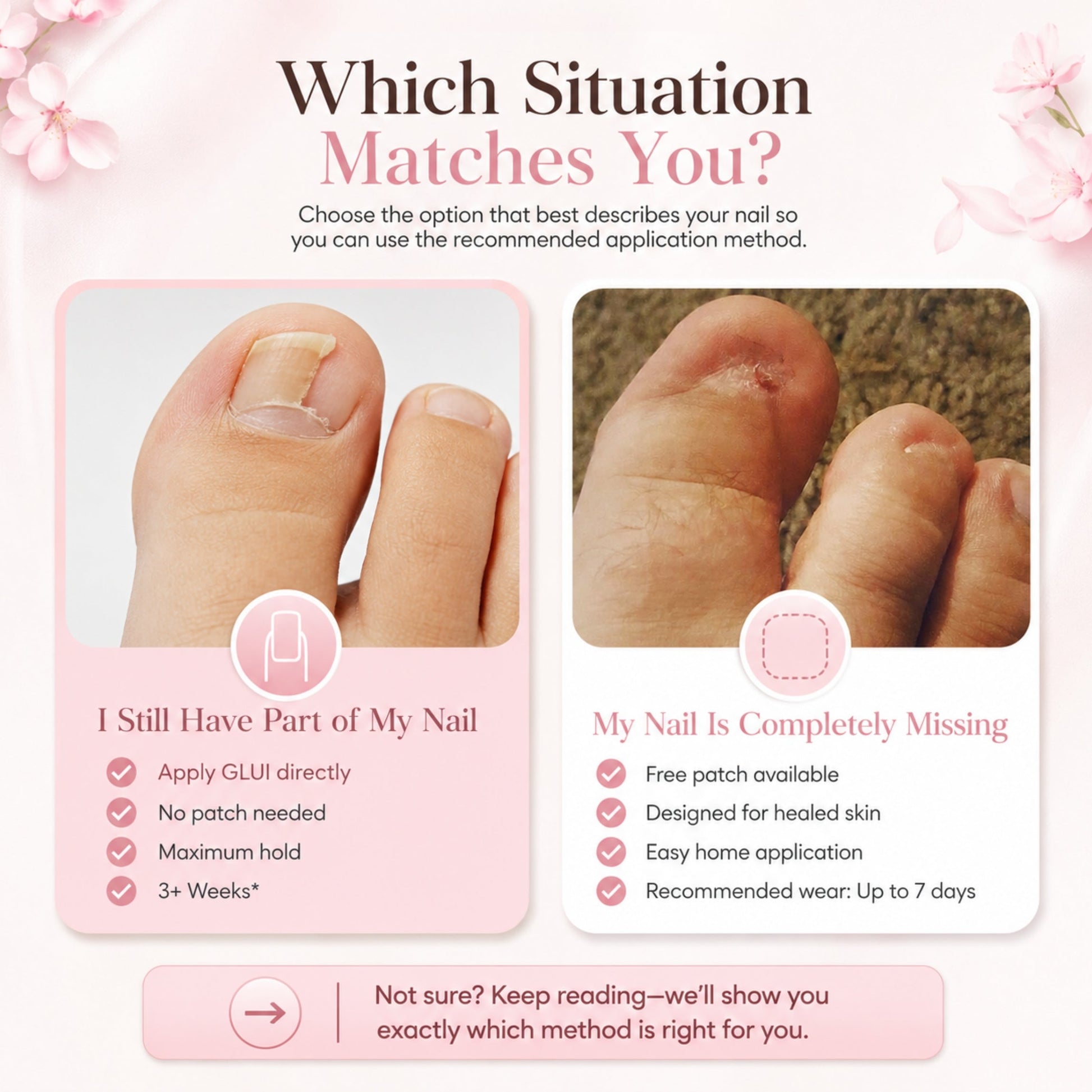 GLUI For Missing & Damaged Toenails
