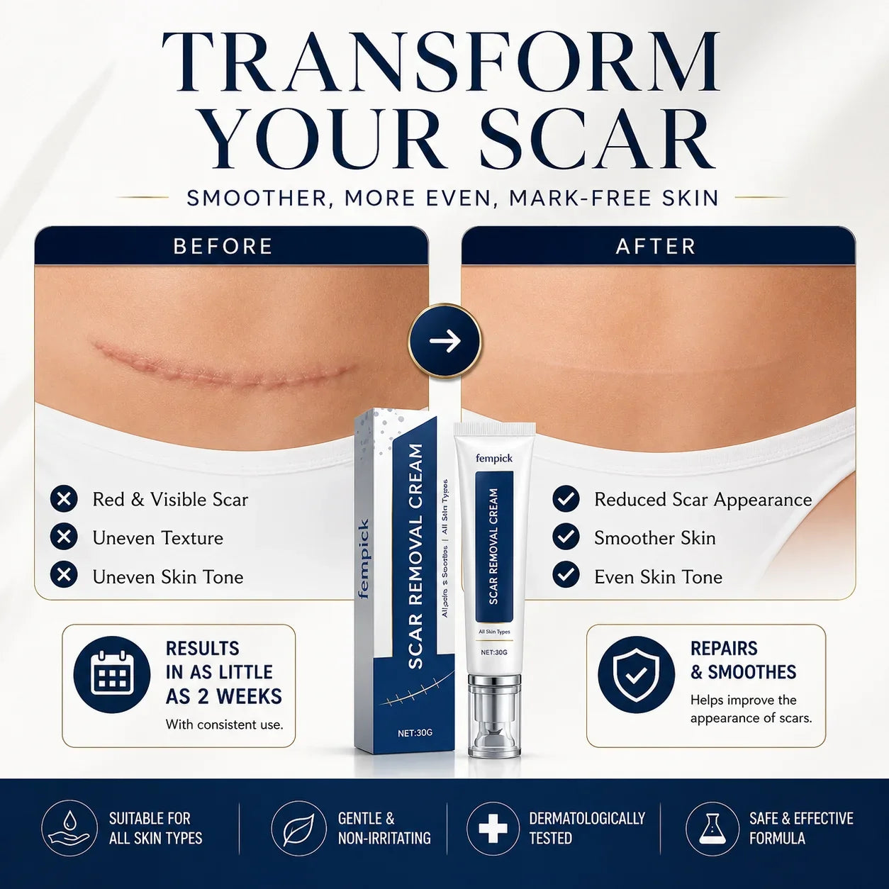 Fempick Scar Smooth – Great Care Cream for All Types of Skin Marks 🧴
