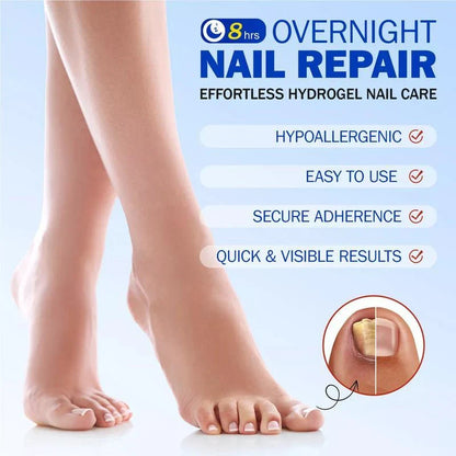 Elevora Fungal Nail Repair Patches