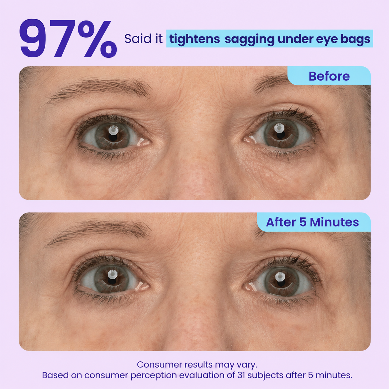 Instant Lift Eye Gel