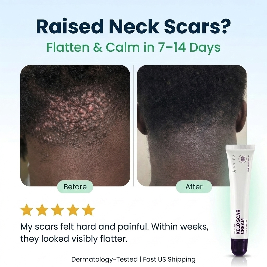 Abera Kelo Scar Care Cream - Top Seller